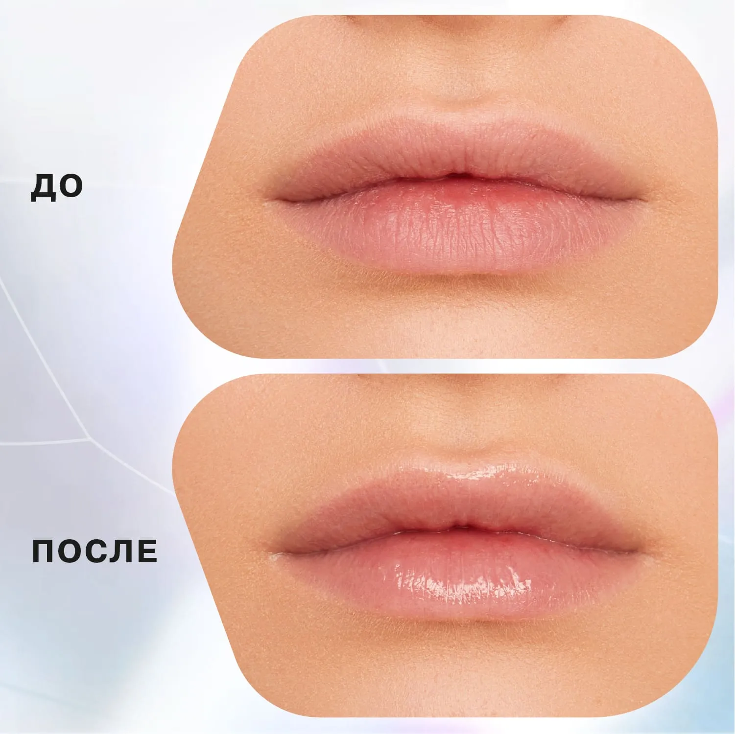 Lip balm jelly