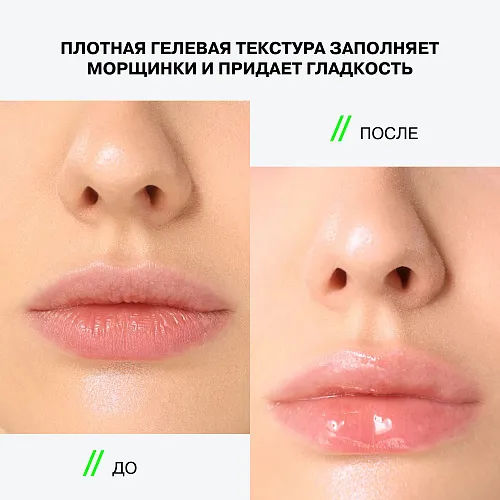 Cryoplump